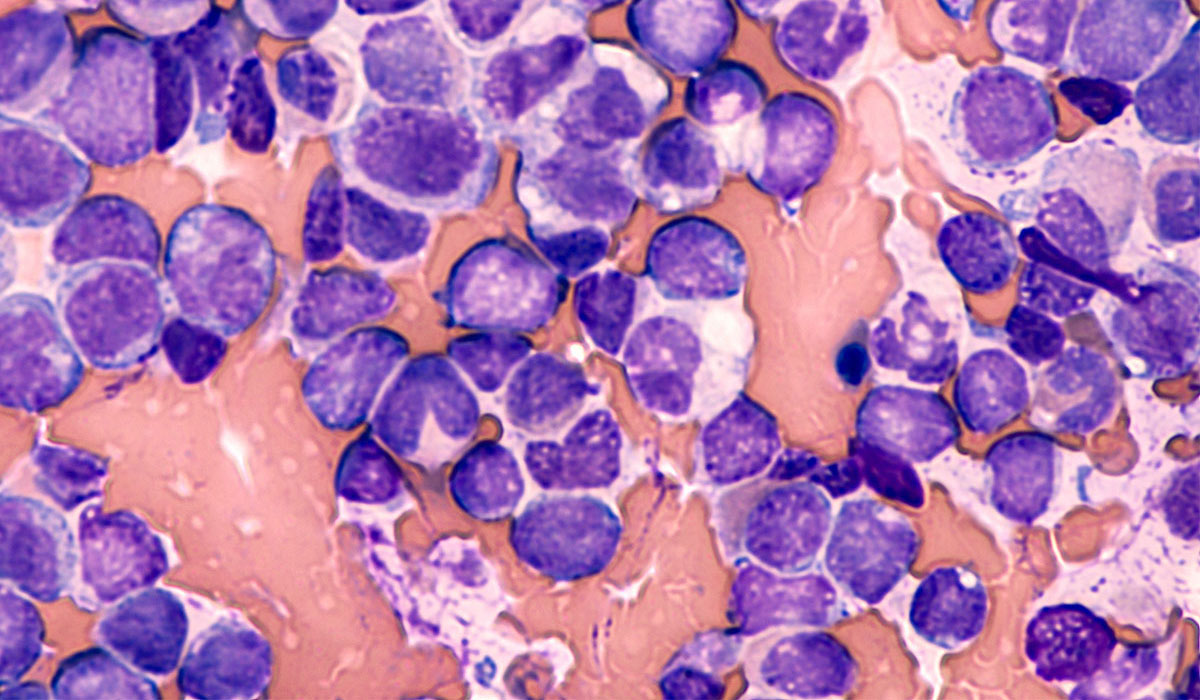 Cell Sorting